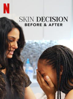 voir Skin Decision: Before and After saison 1 épisode 4